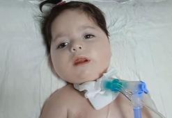 SMA'lı Elanur yardım bekliyor! Gerekli paranın sadece yüzde 11'i tamamlandı