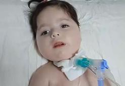 SMA'lı Elanur yardım bekliyor! Gerekli paranın sadece yüzde 11'i tamamlandı