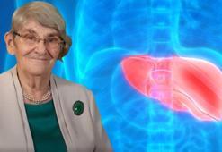 Canan Karatay 'Safra kesesi alınanlar yemesin' dedi! Bağırsakları mahvediyormuş