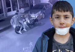 Motosikletlinin çarpıp kaçtı! 7 yaşındaki Yiğit Efe hastanelik oldu