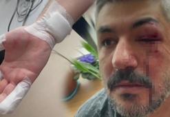 Veliyi hastanelik eden kavga! 'Sizin veremediğiniz eğitimi, ben döverek veriyorum'