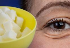 Balon gibi şişen göz altı torbalarından kalıcı olarak kurtarıyor! Asıl nedeni şekermiş