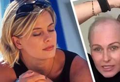 Kansere yakalanan ünlü oyuncudan duygusal paylaşım! Saçlarını kendisi kazıdı