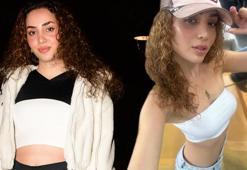 'Herkes saçlarımı soruyor! Bu benim şansım'