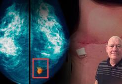 Ağrıyla başladı, sonra göğüs uçları içine göçtü! 'Maalesef erkeklerde daha öldürücü'