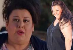 72 kilo veren Esin Gündoğdu'nun son hali şaşırttı! 'Basamak çıkamıyordum'