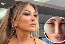 9 saatlik ameliyata girmişti! Operasyonun bedeli dudak uçuklattı