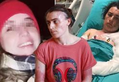 Önce bıçakladı sonra kaynar suyla yaktı! Elti teröründe karar