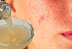 Günde 2 defa yüzünüze sürüp bekletin! Lekeyi ortadan kaldırıyor, cam gibi cildin sırrı