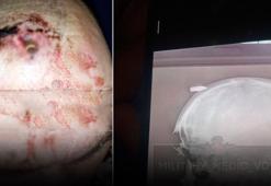 Mermi kafasına saplandı! Telegram gruplarında yayıldı, kurşun dışarıda kaldı