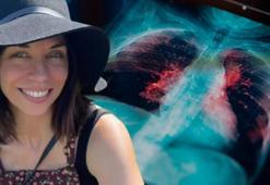 20 kez doktora gidip yalvardı! Geçmeyen öksürük öldürecekti: 'Kritik süre 3 hafta'