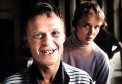 'Akıllı değil' diye vitaminli tek lokma verilmedi! Acıdan kıvrandıran 'çürük diş' deneyi