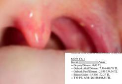 Bademcik ameliyatı sonrası engelli kaldı! 39 milyon liralık rekor tazminat talebi