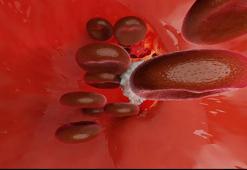 Hemofilide gecikme, kanamalara neden olabilir! ‘Kızlar taşıyıcı, erkekler hasta olur’