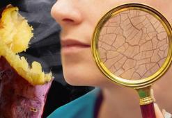 Artan cilt lekelerinin suçlusu meğer bu eksiklikmiş! Haftada 1 kez yenirse silgi gibi siliyor