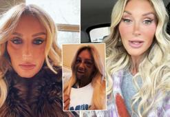 Diş tedavisi bu hale getirdi! 'Canavar gibi hissediyorum' diyerek paylaştı, sosyal medyayı sarstı