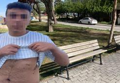 Parkta oturan sevgililere makaslı dehşet! 'Mahallenin namusunu kirlettiniz'