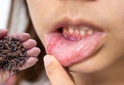 Fast food arttı, ağız ülseri yayıldı! Bu tohumu çiğneyen şanslı, anında yok oluyor