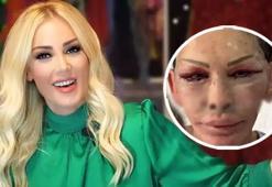 Petek Dinçöz'ün annesi estetik olmuştu! Esra Süay Toğuş'un son hali şaşırttı