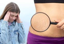 Stresi de selüliti de aynı anda imha ediyormuş! 3 dakika içinde kurtulmanın anahtarı