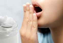 Ağız kokusunun kaynağı bademcik taşları! Çözümü her derde deva o yağda saklı