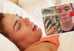 Horlamaya son veren çözüm: Para bandı! 'Yatay değil, dikey yerleştirin'