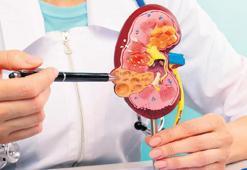 Taş tedavi edilmezse böbrek kaybı yaşatabilir