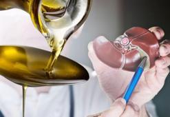 Safra taşlarına savaş açan zeytinyağı mucizesi! Eriterek kırıyor, tek tek temizliyor