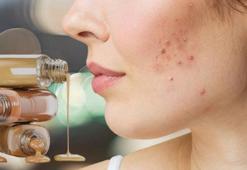 Yara izini kapatmanın tekniği bambaşka! Türüne göre değişiyormuş, önce nötrleyin