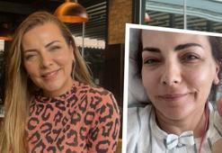 Burcu Kara apar topar ameliyat oldu! 'Alınmasına karar verildi ama riskleri vardı'