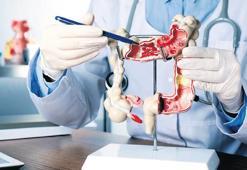 Kolon ve rektum kanserlerinde  kişiye özel tedavi dönemi