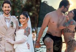 Melek Mosso'dan kalça estetiği itirafı! Eşi Serkan Sağdıç sebebini açıkladı