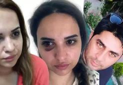 Bir yıldır boşanmak istediği eşi darbedip, bıçakladı