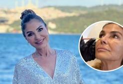 İbrahim Tatlıses'in eski eşi Derya Tuna estetik yaptırdı! Yüzünü gerdiren ismin değişimi olay oldu