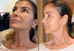 Derya Tuna'dan 'yüz gerdirme' cevabı! 'Estetikle işim olmaz'