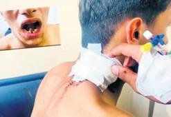 Eğlence değil 'olası kast'