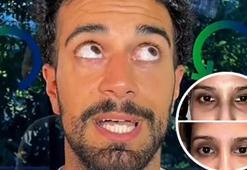 Göz yogası olay yarattı! 'Hindistan'da öğrendim, gözlükten tamamen kurtuldum'