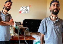 Linç edilince yeteneğine kavuştu! Boğazındaki delikle şarkı söyleyen sayılı insanlardan