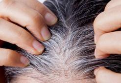 Beyaz saçlar koparınca çoğalır mı? Yıllardır bu efsaneyle yaşıyoruz, cevabı şaşırttı
