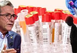 Genç kalmak için oğlunun kanını aldı! Prof. Dr. Müftüoğlu: 'Uyarıya kulak verin'