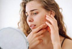 Cilt döküntülerine birebir çözüm! Vitamin içeriği parlatıyor