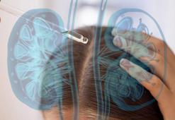 Saça kullanılıyor ama herkese uygun değil! Kıvırcıklar düzleşiyor