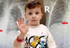 Nefes borusundaki çekirdekle 3 yıl yaşadı