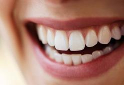 Doğal yollardan diş beyazlatan karışım! Haftada bir fırçalamak yetiyor