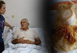 Seyyar satıcıdan alınan mantar 3 aileyi hastanelik etti!