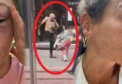 Korkunç rakam! Bursa'da ilk 6 ayda, 6 bin 537 kadın ile 755 erkek eşlerinden şiddet gördü