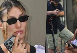 Şevval Şahin: Yüzümde alerji var!