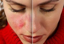 Rozanız varsa bunlardan kaçın! Yeşil tonlu baz şart, makyaja dikkat