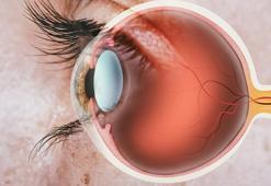 Şahin gibi gözler için yeşil yapraklara yönelin! Gözlükten uzaklaştırıyor, yorgunluk bırakmıyor