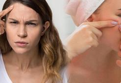 Ev yapımı sivilce kurutan tariften uzak durun! Asit bombası çıktı, uyarı geldi